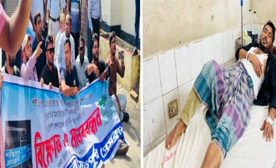 শরীয়তপুরে সাংবাদিকের উপর সন্ত্রাসী হামলা