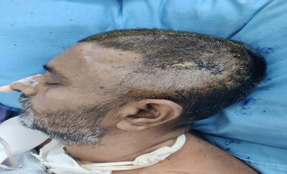 সন্ত্রাসীদের হামলায় আহত আজিবরের মৃত্যু, ২৬ দিন পর না ফেরার দেশে